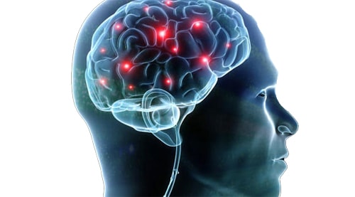 Brain Surgery