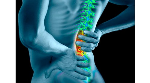 Lumber Spine Surgery